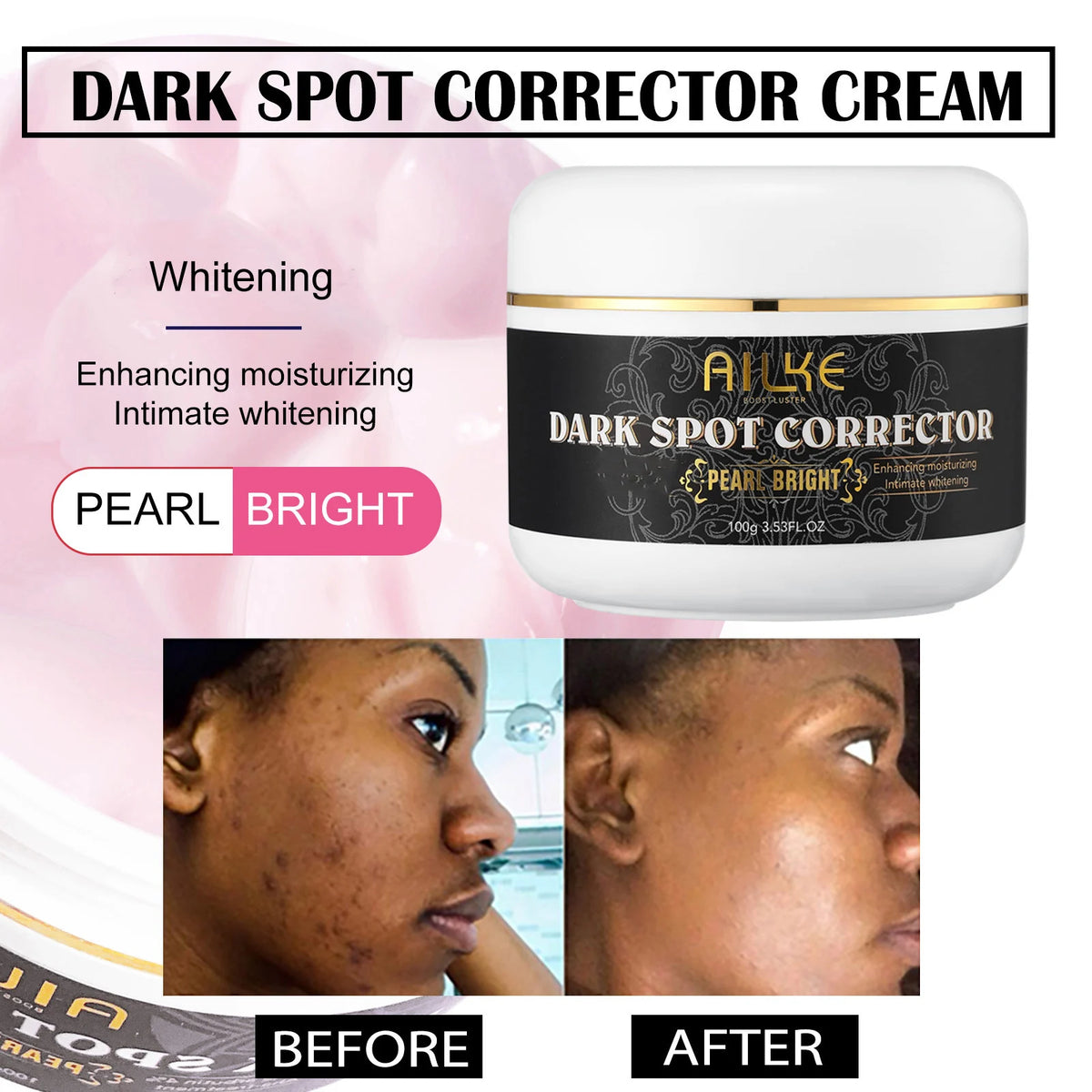 AILKE Collagen Whitening Kit, Skin Moisturizer, Hydration, Remove Dark Spots, Sun Spots, Freckles, Melanin, Even Skin Tone