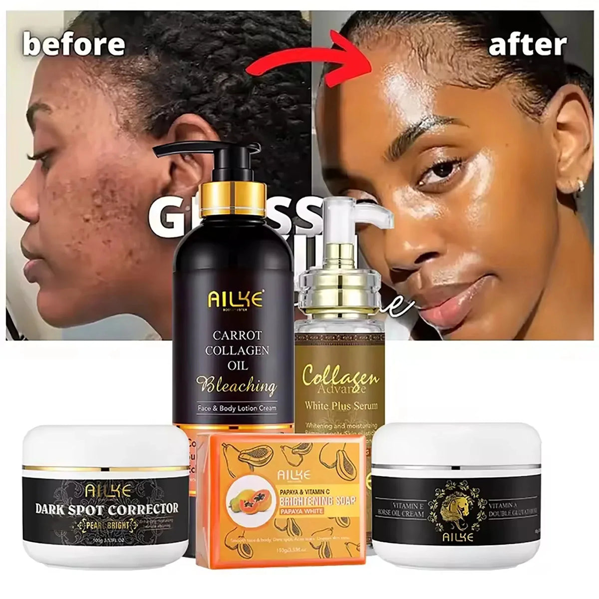 AILKE Collagen Whitening Kit, Skin Moisturizer, Hydration, Remove Dark Spots, Sun Spots, Freckles, Melanin, Even Skin Tone