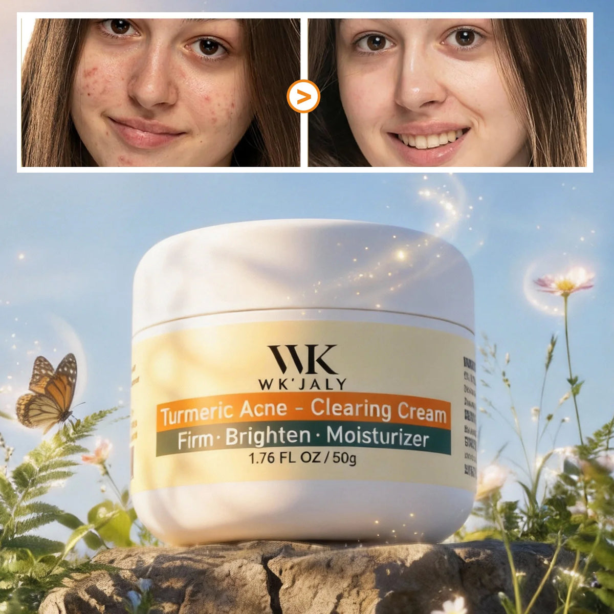 Turmeric Brightening Face Cream for Acne Dark Spots and Uneven Skin Tone