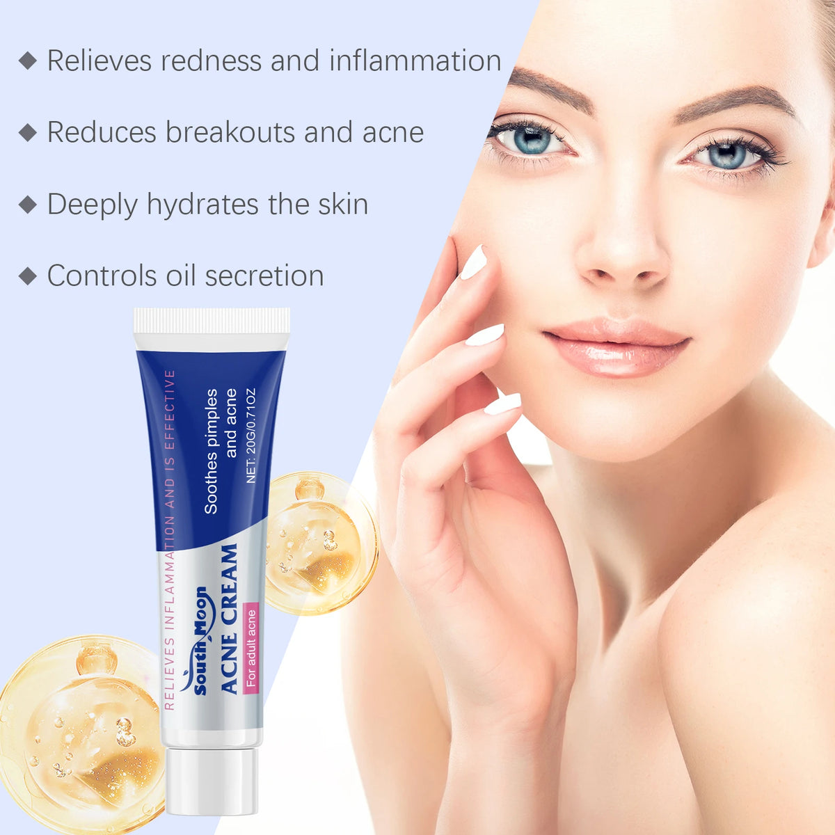 South Moon Anti Acne Cream for Oil Control and Acne Mark Care